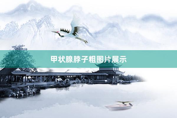 甲状腺脖子粗图片展示